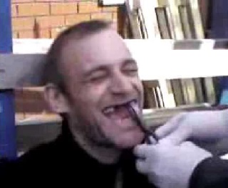 В Чаплынском районе, чтобы не мобилизовываться, рвут себе зубы плоскогубцами