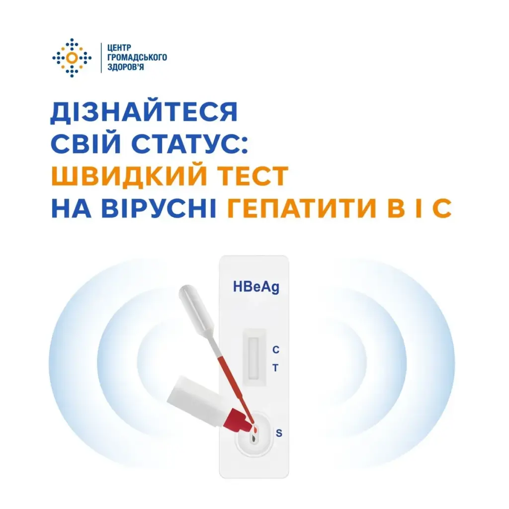 Херсонщина долучається: розпочався Тиждень тестування на вірусні гепатити