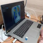 Мобільний рентген-кабінет працює для обстеження органів дихання в Херсонській області