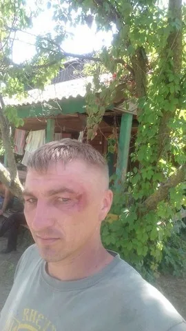 “Полицейские” из Днепра избили инструкторов-атошников из детского лагеря
