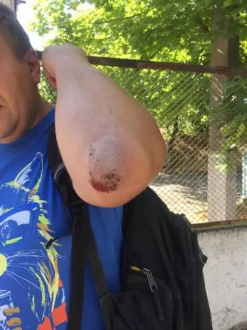 В Херсоне избили журналиста