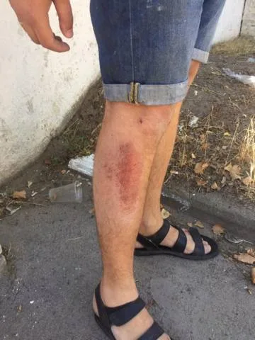 В Херсоне избили журналиста