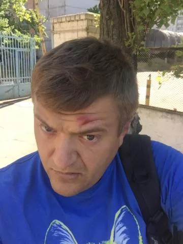 В Херсоне избили журналиста