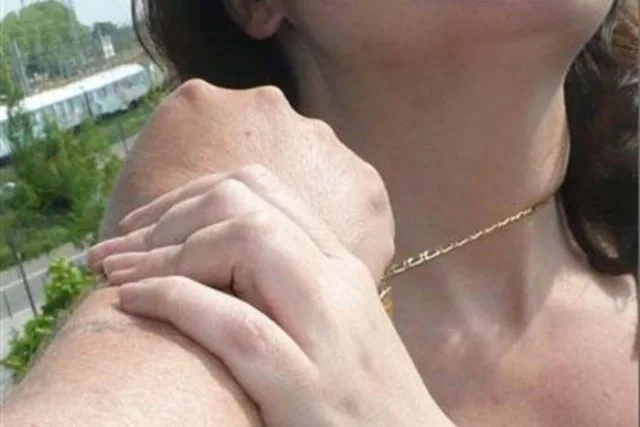 В Херсоне снова рвут серьги из ушей