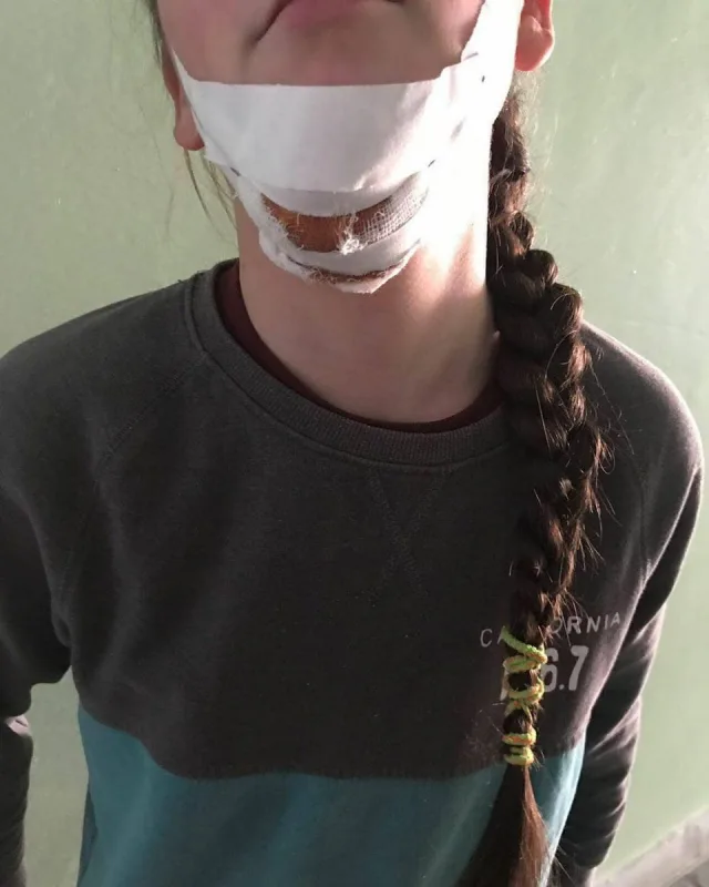 В полиции сообщают, что в Херсоне девушку никто не резал