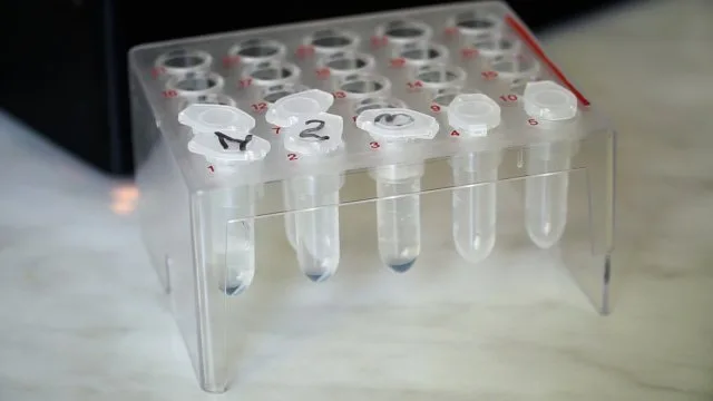 На Херсонщине еще одна лаборатория будет тестировать на COVID-19